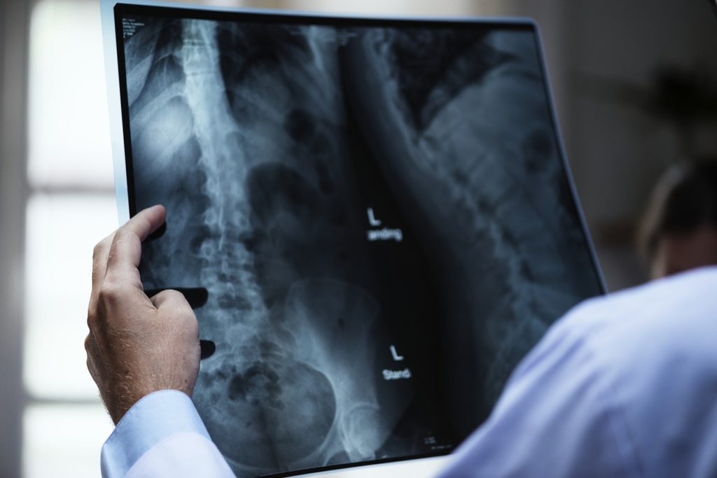 Wat is een X-ray? Oftewel: waarom sourcen een vak apart is